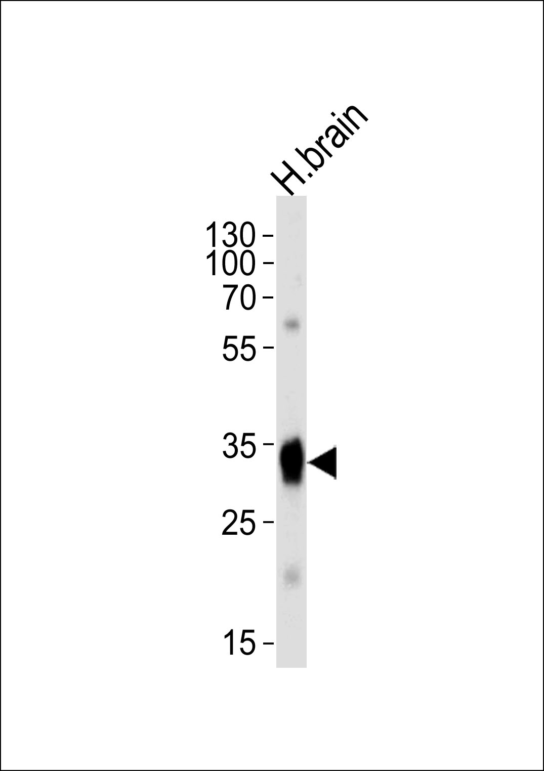 SULT4A1a/b (N-term)
