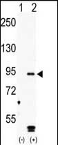 Rabbit Polyclonal Antibody to MARK4