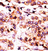 Rabbit Polyclonal Antibody to PANK1