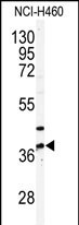 PANK3 (N-term)