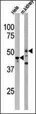 PSKH1 (N-term H70)