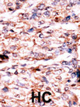 Rabbit Polyclonal Antibody to PSKH1 (N-term H70)
