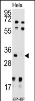 UCK2 (N-term)