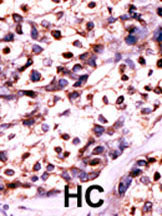 Rabbit Polyclonal Antibody to UCK2 (N-term)