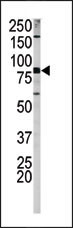 Phospho-APP(S730)