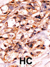 Rabbit Polyclonal Antibody to Phospho-Bad(S118)