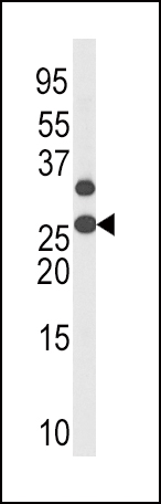 Phospho-p27Kip1(T187)