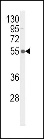 Phospho-TNFR(S274)