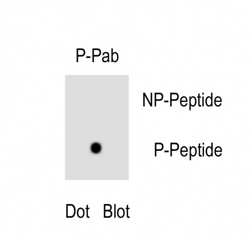 Rabbit Polyclonal Antibody to Phospho-TNIK(S764)