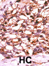 Rabbit Polyclonal Antibody to Phospho-TNIK(S764)