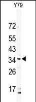 DSCR3 (N-term)