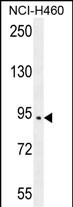 SPARCL1