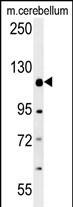 Rabbit Polyclonal Antibody to RADIL