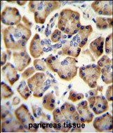 Rabbit Polyclonal Antibody to RADIL