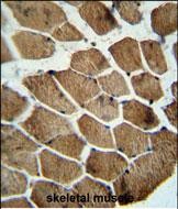 Rabbit Polyclonal Antibody to MOCS1