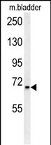 SLC25A12 (N-Term)