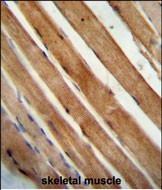 Rabbit Polyclonal Antibody to SLC25A12 (N-Term)