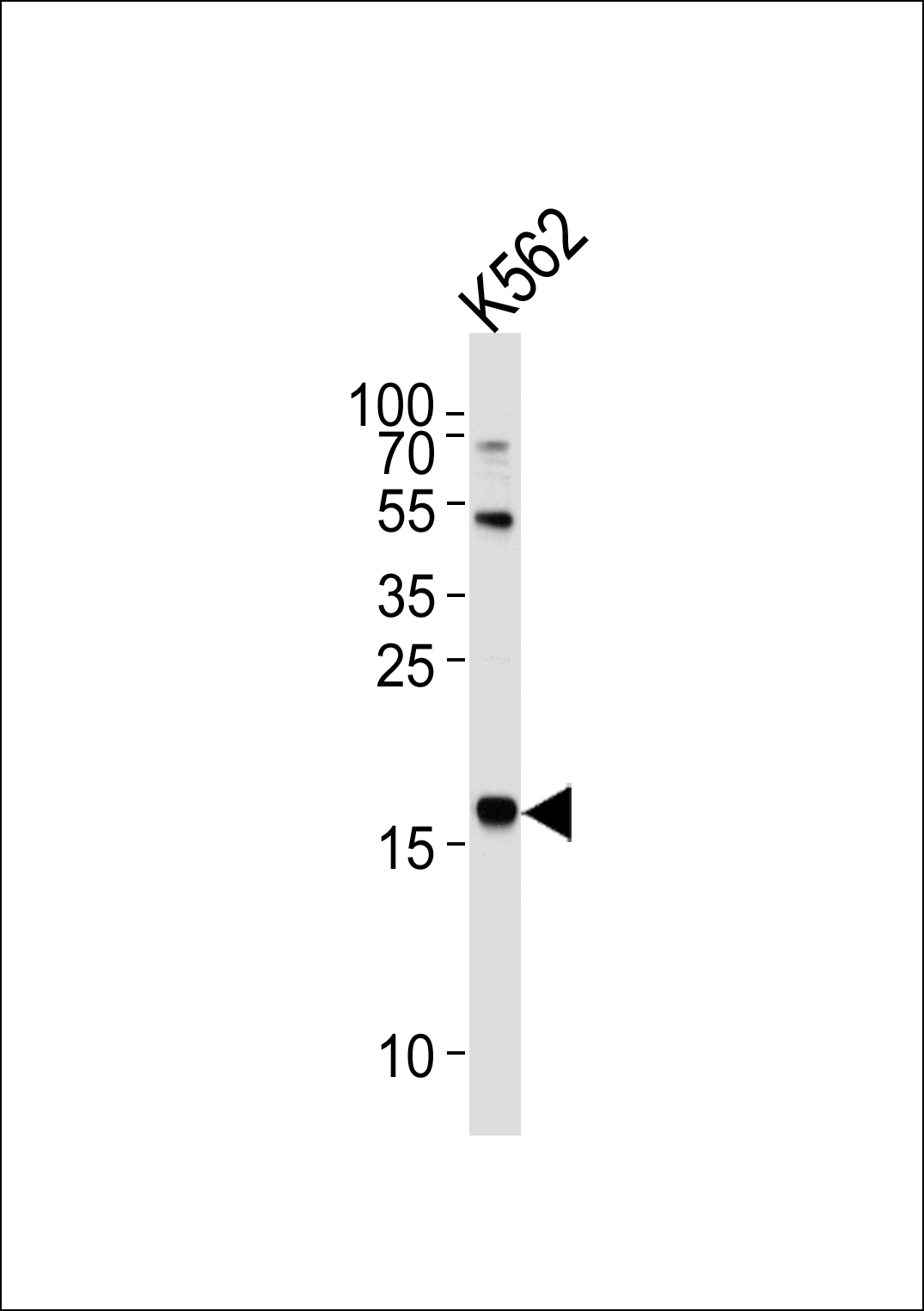 NAT14 (N-term)