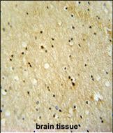 Rabbit Polyclonal Antibody to VWA3B