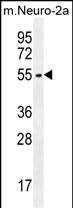 ZDHHC1 (N-term)