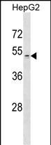 Rabbit Polyclonal Antibody to ZDHHC1 (N-term)