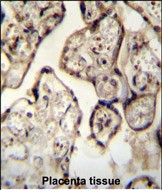 Rabbit Polyclonal Antibody to SYT8