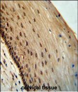 Rabbit Polyclonal Antibody to SPDYE3