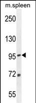 Rabbit Polyclonal Antibody to EFTUD1