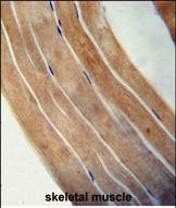 Rabbit Polyclonal Antibody to EFTUD1