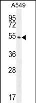C1orf51 (N-term)