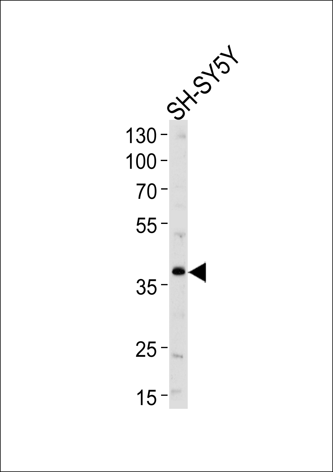 SERPINI1 (N-term)