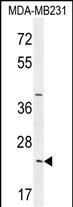 SYCE2  (N-term)