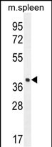 LHFPL5
