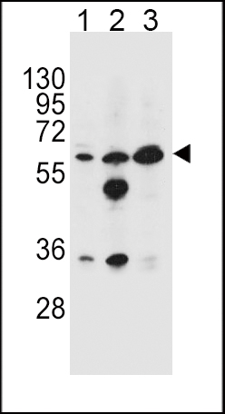 GATM (N-term)