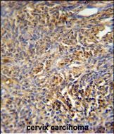 Rabbit Polyclonal Antibody to TANK