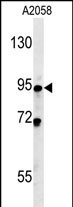 SMPD4 (N-term)