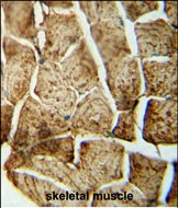 Rabbit Polyclonal Antibody to SMPD4 (N-term)