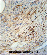 Rabbit Polyclonal Antibody to KIF9