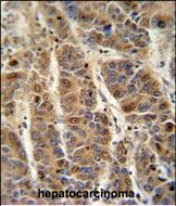 Rabbit Polyclonal Antibody to C4BPA