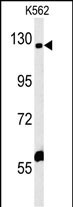 IQSEC3 (N-term)