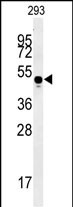 MYLK4