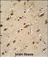 Rabbit Polyclonal Antibody to MYLK4
