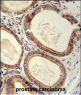 Rabbit Polyclonal Antibody to TRAM2