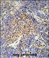 Rabbit Polyclonal Antibody to OTUD4 (N-term)