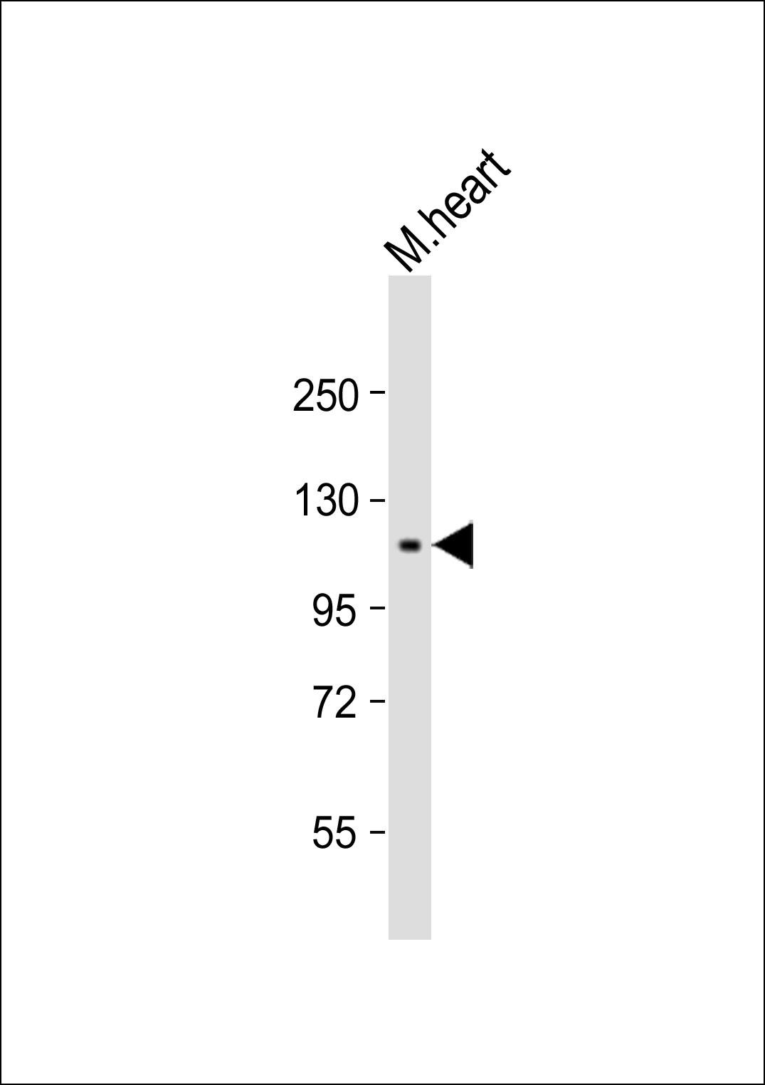 Mouse Monoclonal Antibody to RET