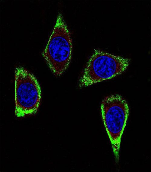 Mouse Monoclonal Antibody to RET