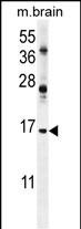 Rabbit Polyclonal Antibody to ENSA