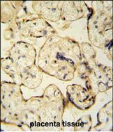 Rabbit Polyclonal Antibody to CLIC6