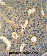 Rabbit Polyclonal Antibody to MICALL1