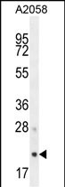 AP3S1 (N-term)